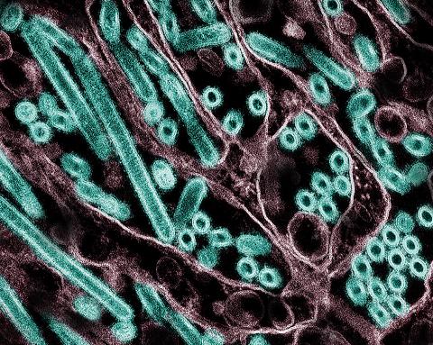 Image of Avian Influenza H5N1
