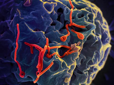 picture of virus